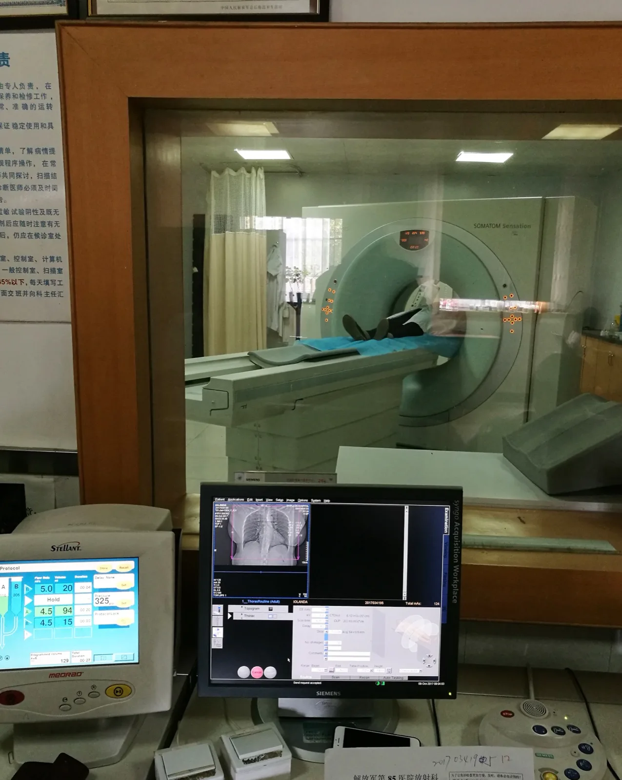 A radiologist reviews CT scan images showing coronary artery calcium on a computer monitor in a clinical setting.
